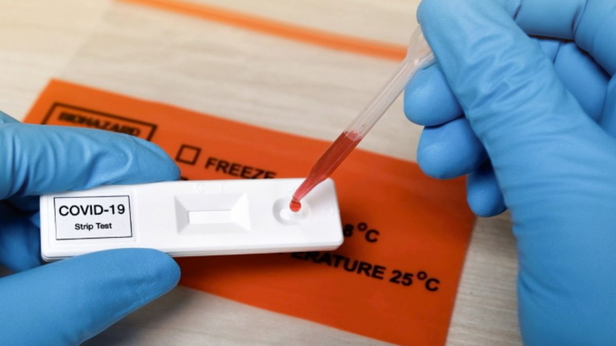 O testare în masă au făcut autoritățile în Slovacia, rata infecărilor a scăzut
