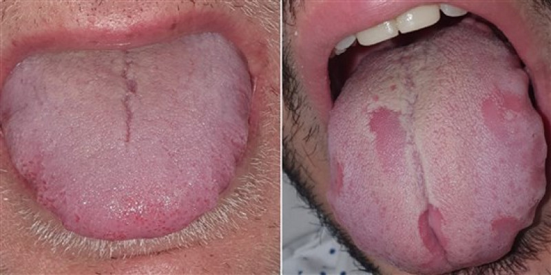Foto: British Association of Dermatologists/John Wiley and Sons