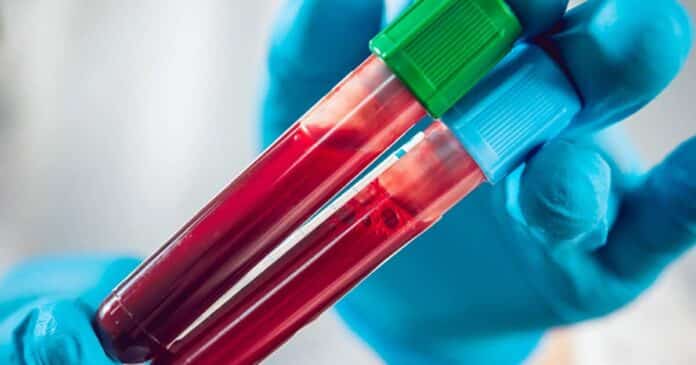 Evoluția unei infecții îngrijorează medicii de pe tot globul.